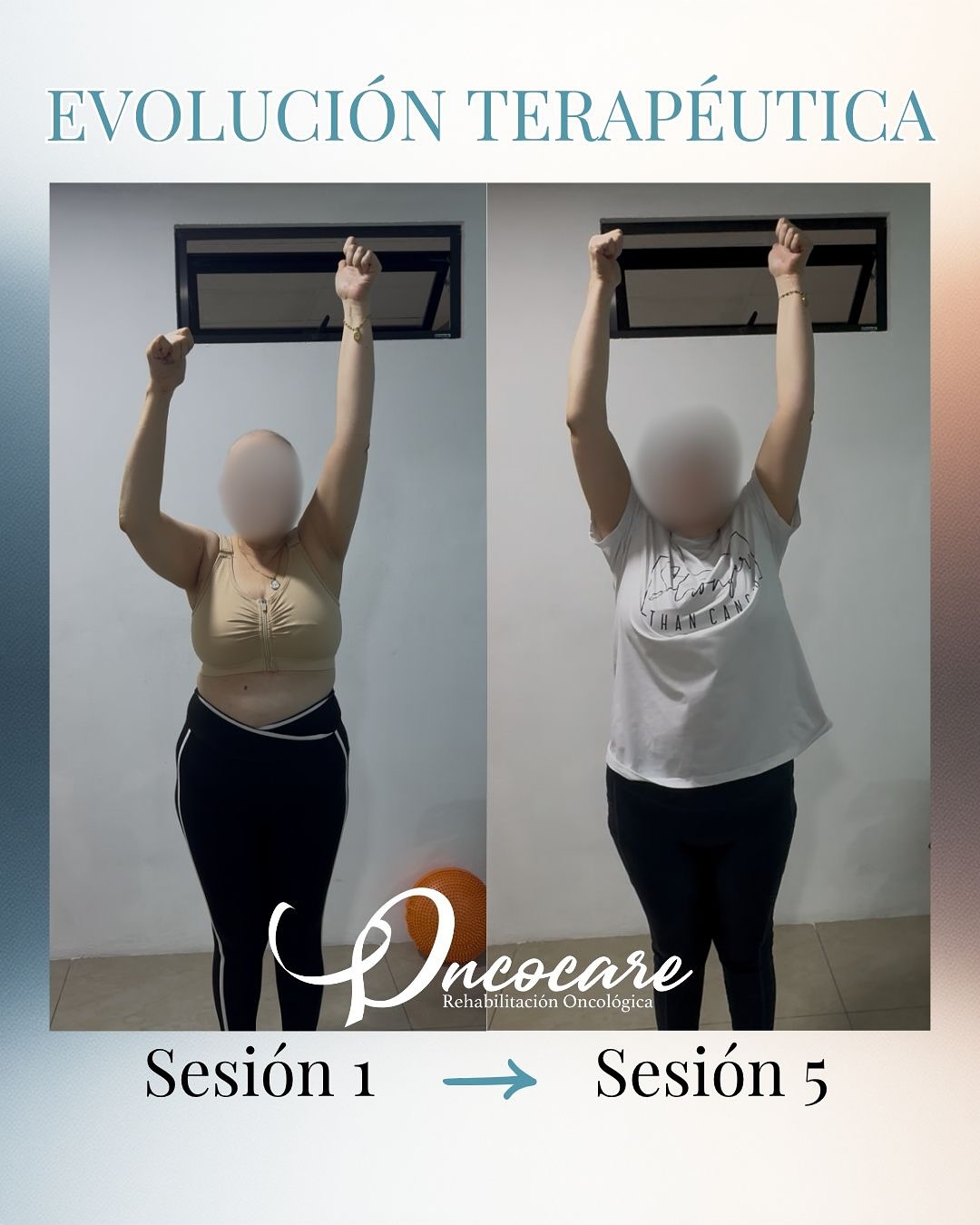 Rehabilitación temprana que marca la diferencia ✨
En Oncocare acompañamos a esta paciente después de su cirugía por cáncer de mama con disección axilar completa. Gracias al inicio temprano de la terapia y a su compromiso constante, hoy muestra una evolución funcional significativa ✨
Con el seguimiento adecuado y constancia, la recuperación avanza de forma segura y efectiva 🍃
En Oncocare podemos ayudarte:
📲 8707-8837
🏠 Mall Dorado, Goicoechea
#oncocarecr #terapiafisicaencancer #rehabilitaciónoncológica #cáncerdemama #terapiafisicayrehabilitación #sanjosecostarica