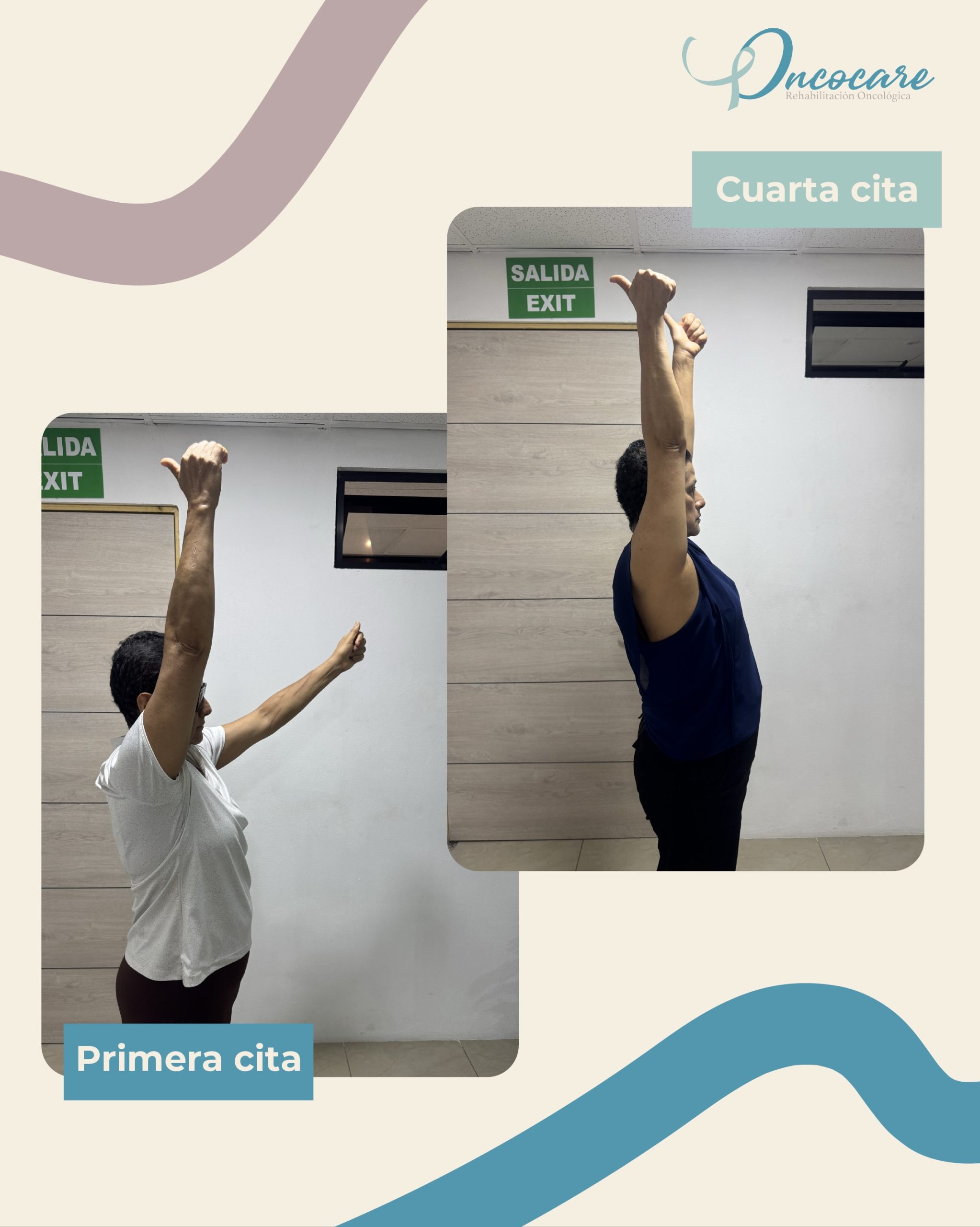 La fisioterapia oncológica marca la diferencia en la recuperación post cirugía por cáncer de mama.
No normalicemos el dolor o la limitación del movimiento siempre hay un camino para mejorar. ✨

Agenda tu cita y da el siguiente paso hacia tu recuperación
📲 8707-8837 
🏠 Mall Dorado, Goicoechea 

#fisioterapia #rehabilitaciónoncológica #cáncerdemama #ejercicioencancer