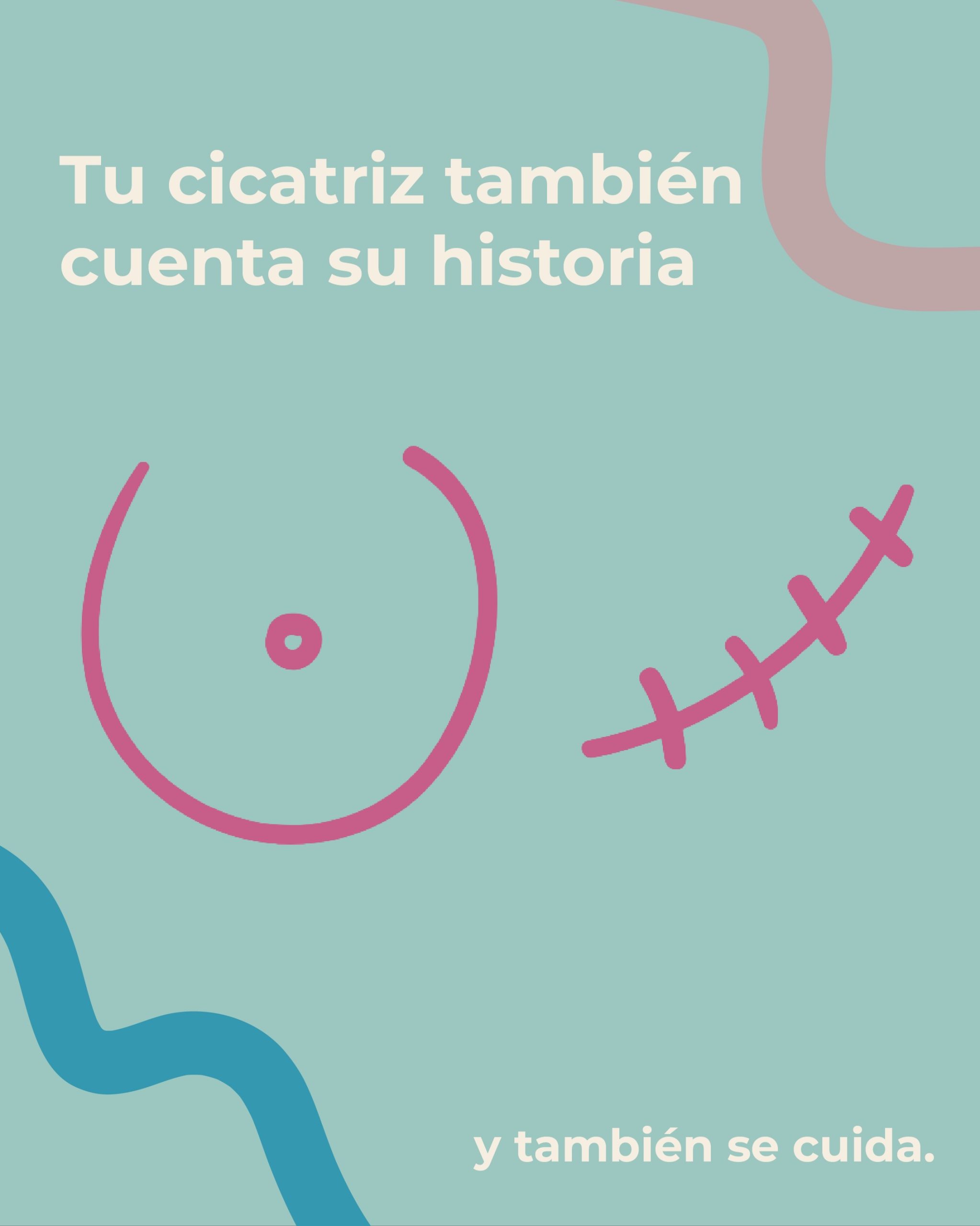 ¿Sabías que la fisioterapia también puede ayudarte a recuperar la movilidad de tu cicatriz después de una cirugía por cáncer de mama? 💗
Después de una mastectomía o cirugía conservadora, la cicatriz puede generar tirantez, dolor, sensibilidad y limitación para mover el hombro y el brazo.
Tu cicatriz cuenta una historia, pero no tiene que limitar tus movimientos.
Con una valoración individualizada y técnicas adecuadas, podemos acompañarte en tu proceso de recuperación, respetando cada etapa de cicatrización.
📍 Guadalupe, Mall Dorado.
📲 Agenda tu valoración al 8707-8837.
#cancerdemama🎀 #fisioterapia #rehabilitaciónoncológica #sanjosecr #oncocarecr